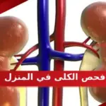 فحص الكلى في المنزل وطرق الاختبار الصحيحة