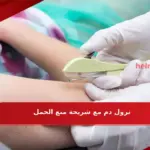 نزول دم مع شريحة منع الحمل كيف توقف نزول دم