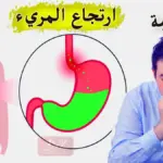 أعراض ارتجاع المريء النفسية وطريقة علاجها