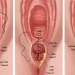كيفية تضييق المهبل بعد الولادة بدون خياطة