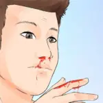 تفسير خروج الدم من الأنف في المنام للعزباء والمتزوجة لابن سيرين