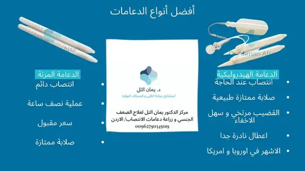 تجربتي مع الدعامه الذكريه العيوب والمميزات ونسبة النجاح