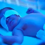 علاج صفار المواليد بالماء والسكر وطريقه تحضيره
