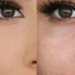 تصغير مسامات الوجه تجربتي الناجحة