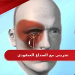 تجربتي مع الصداع العنقودي