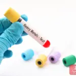 تجربتي مع تحليل المعادن وكم أسعارها