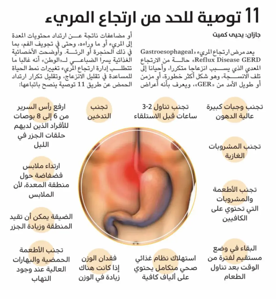 أعراض ارتجاع المريء النفسية وطريقة علاجها