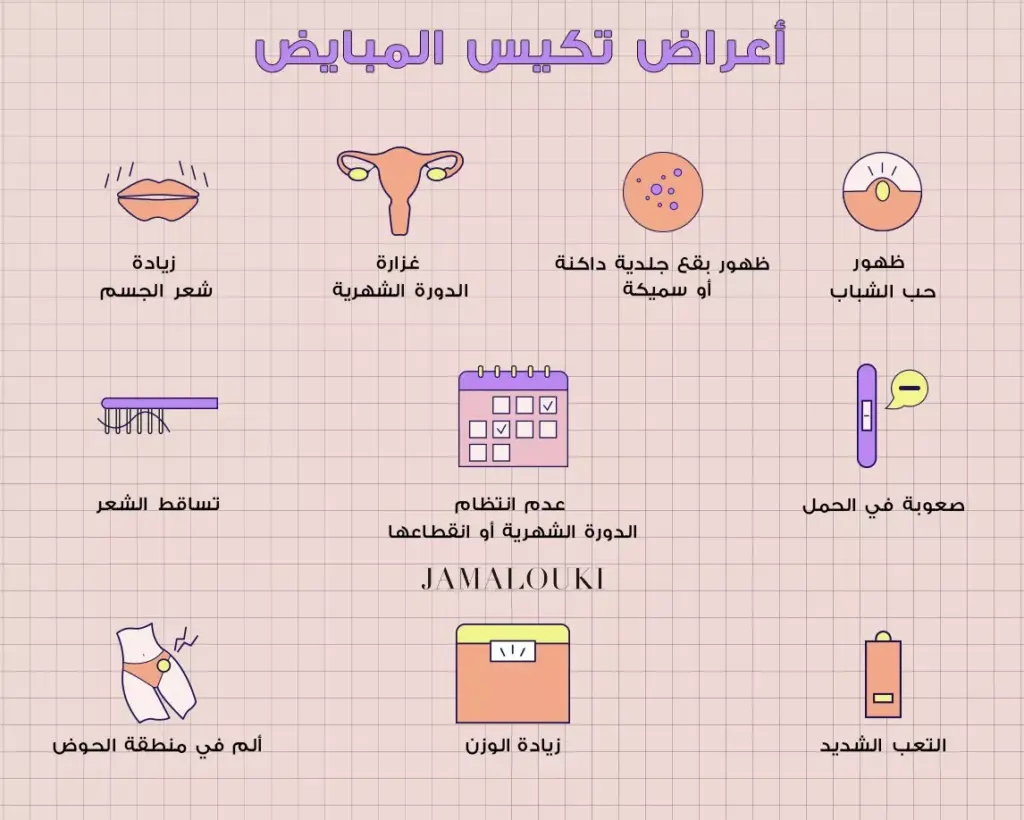 كيف اعرف ان تكيس المبايض راح 