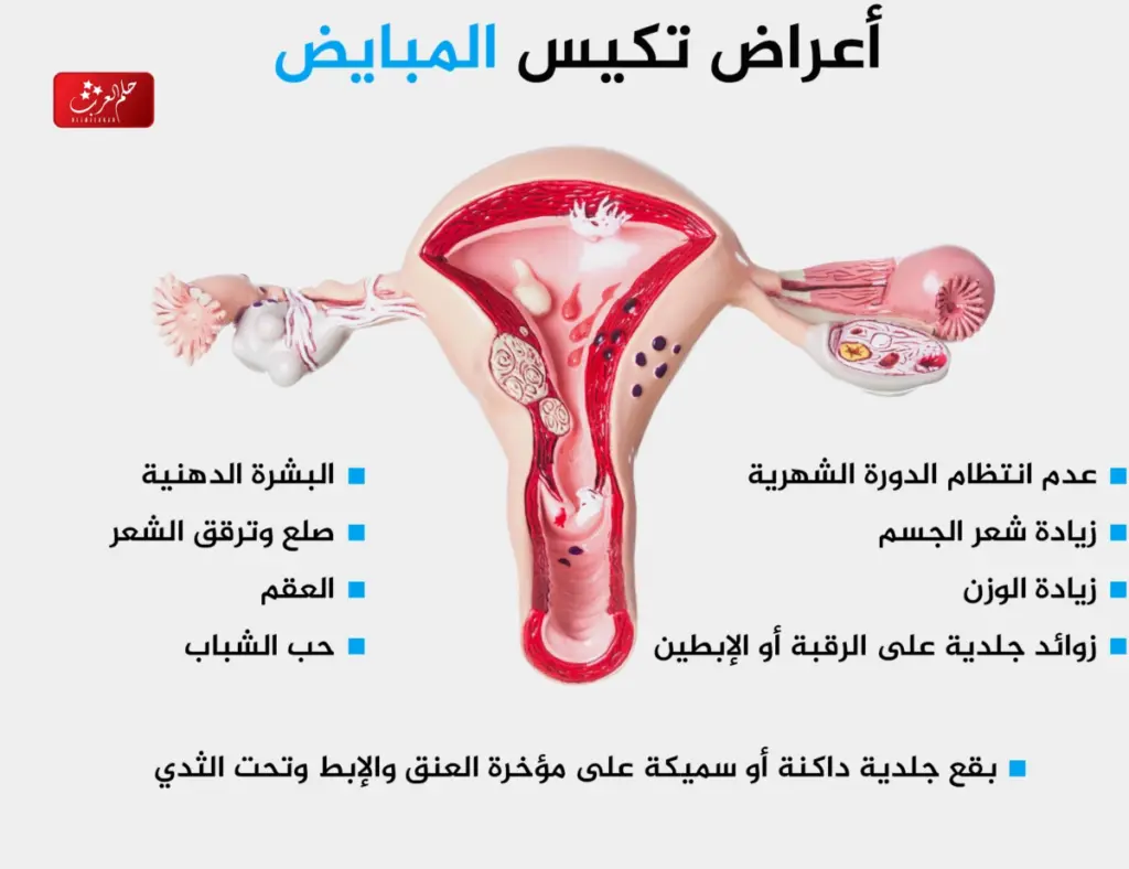 أفضل وقت لعمل سونار تكيس المبايض للحصول على نتيجة دقيقة