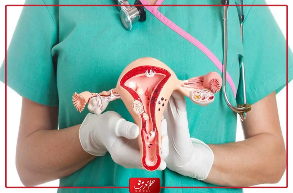 اين يذهب ماء الرجل بعد استئصال الرحم وما تأثيره علي الزوجة