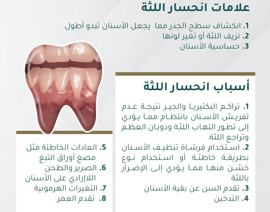 تجربتي مع انحسار اللثه