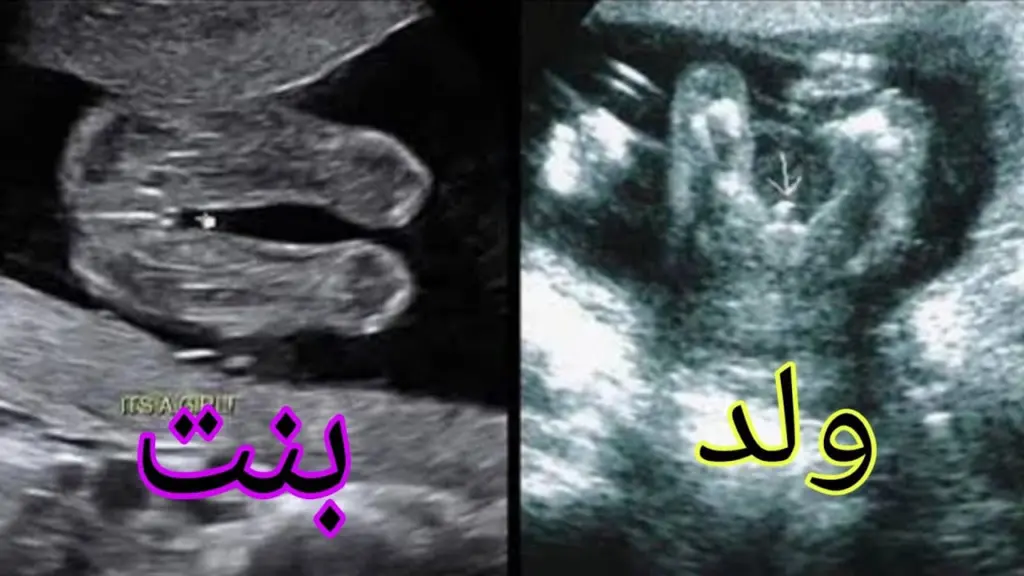 كم نسبة صحة السونار في الشهر الرابع مع تجارب الناس