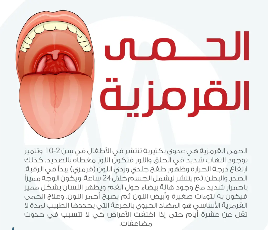 تجربتي مع الحمى القرمزية الأسباب والأعراض وكيفية العلاج