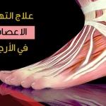 تجربتي في علاج شد الأعصاب في الرجلين