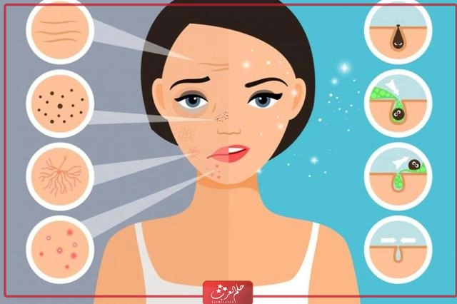 تجربتي مع التقشير البارد وأهم أضراره وفوائده علي البشره