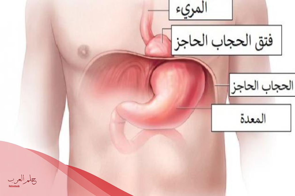 تجربتي مع فتق الحجاب الحاجز وأهم اعراضه