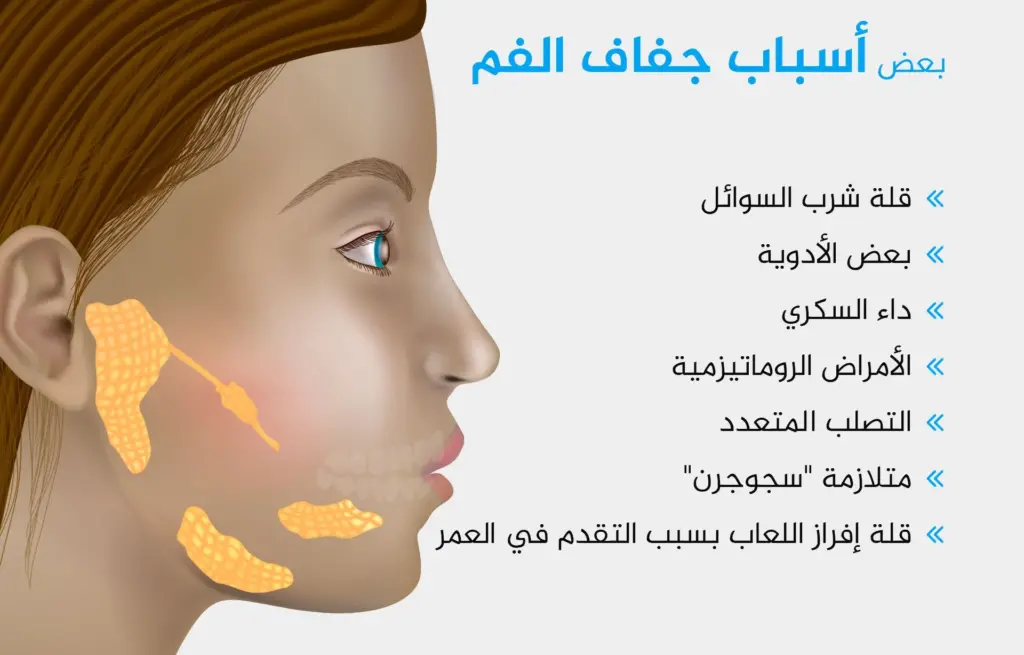 هل المعدة تسبب جفاف الفم والحلق