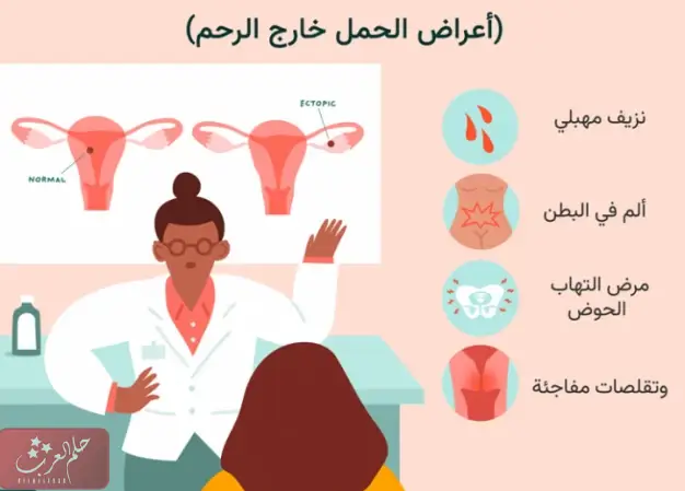 تجربتي مع الحمل خارج الرحم