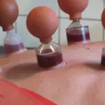 علامات خروج العين والحسد بالحجامه وابرز علامات نجاح الحجامه