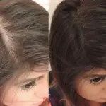 تجربتي مع زيت الزنجبيل للشعر