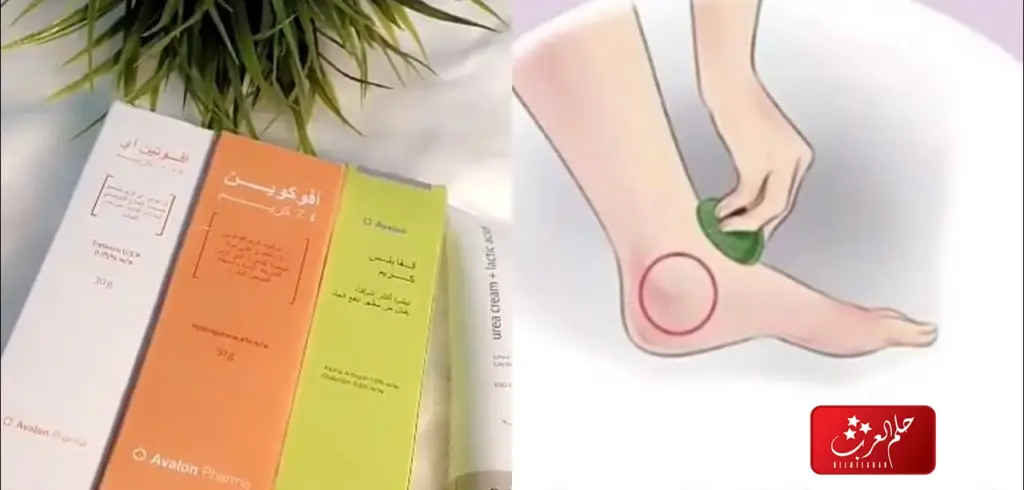 تجربتي مع سواد جوزة القدم أسبابها وكيفية علاجها
