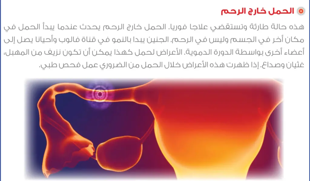 تجربتي مع الحمل خارج الرحم