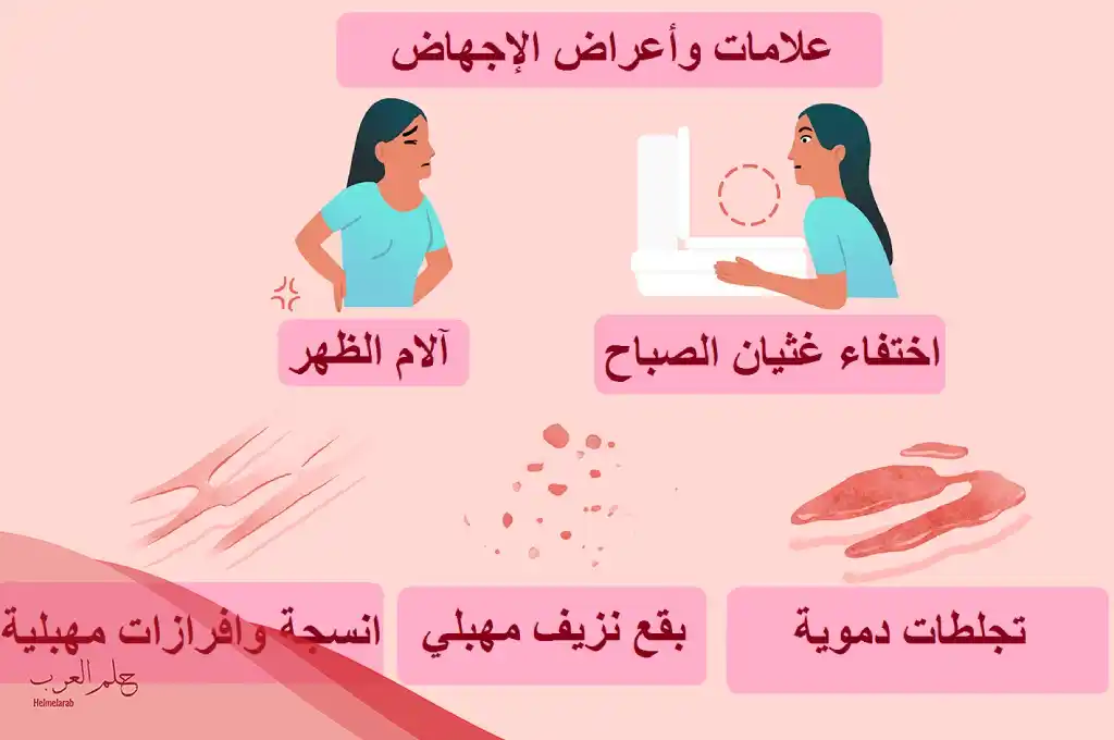 أشهر حبوب تنزل الجنين من الصيدلية النهدي مجربة