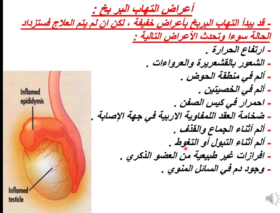 تجربتي مع التهاب البربخ وطريقة علاجه