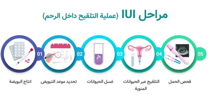 تجربتي مع التلقيح الصناعي للحمل بولد
