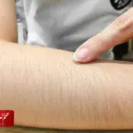 الفرق بين الشعر الوبري والسميك
