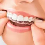 تجربتي مع مثبت التقويم