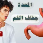 هل المعدة تسبب جفاف الفم والحلق