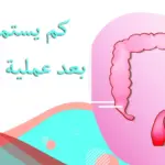 كم يستمر الالم بعد عملية البواسير