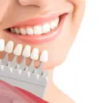 تجربتي مع تركيبات الزيركون عالم حواء