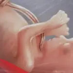 تجربتي مع زيادة الماء حول الجنين وكيفية التخلص من الماء الزائد