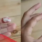 هل نزول افرازات مثل زلال البيض من علامات الحمل؟ وما سبب نزولها