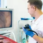 تجربتي مع منظار القولون بدون تخدير وهل هو مؤلم؟