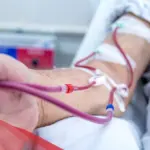 تجربتي مع الغسيل البريتوني ومعلومات عن أهم الانواع والأضرار