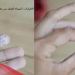 هل الافرازات البيضاء الثقيلة من علامات الولادة عالم حواء
