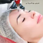 تجربتي مع الديرما بن: فوائدها واضرارها للبشرة