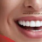 هل يوجد علاج لتثبيت الاسنان المخلخلة، وهل هو خطير؟