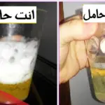 هل يتفاعل الكلور مع البول بدون حمل، وعلى ماذا يدل فوران البول مع الكلور