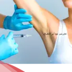 تجربتي مع ابر التعرق وهل هي مضره؟