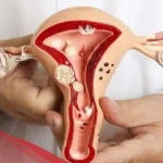 ألم المهبل للعذراء: الأسباب وطرق علاجها