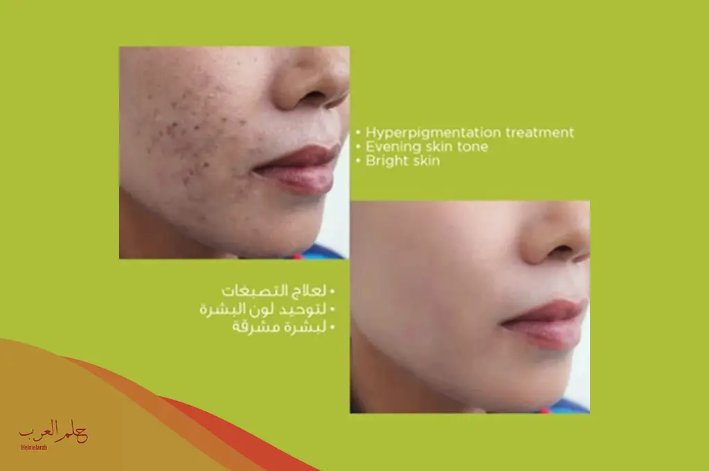 تجربتي مع كريم الفا بلس المميزات والعيوب وطريقة الاستخدام