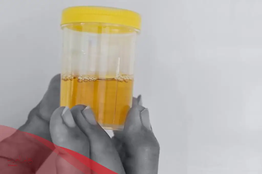 هل شوائب بيضاء في البول من علامات الحمل؟