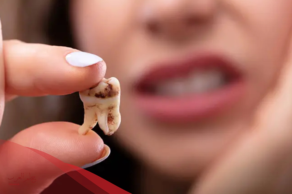تفسير حلم تسوس الأسنان للمتزوجة والعزباء في المنام لابن سيرين