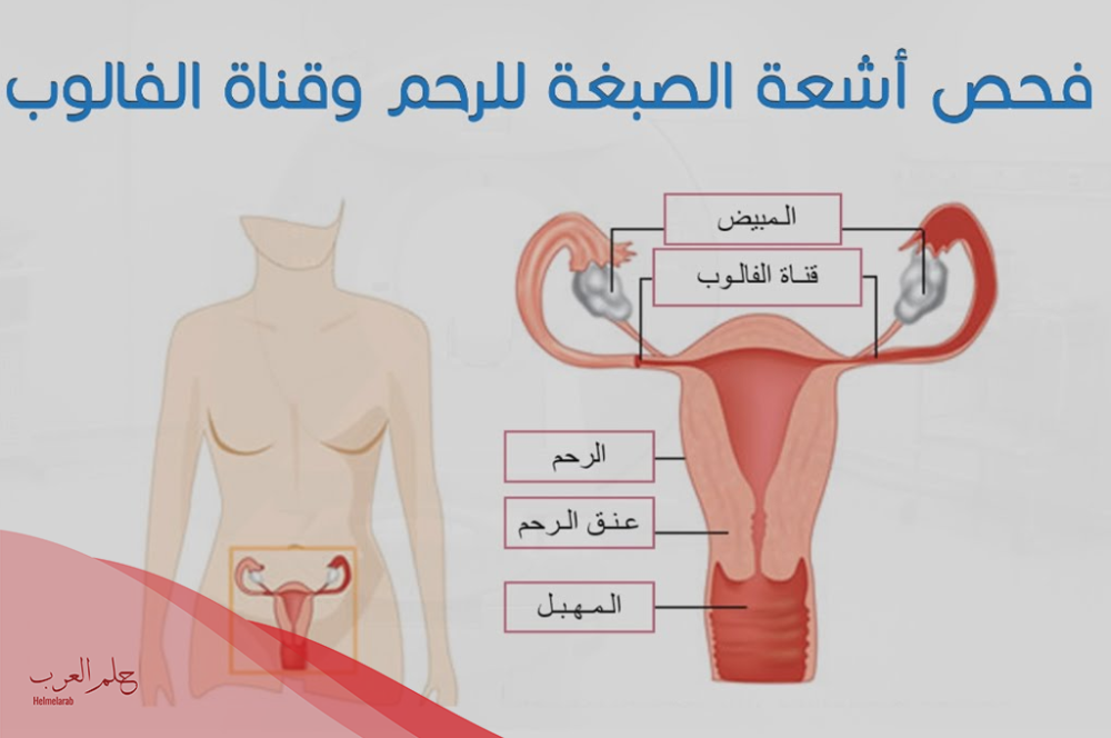 نسبة الحمل بعد اشعة الصبغة