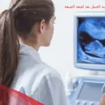 نسبة الحمل بعد اشعة الصبغة