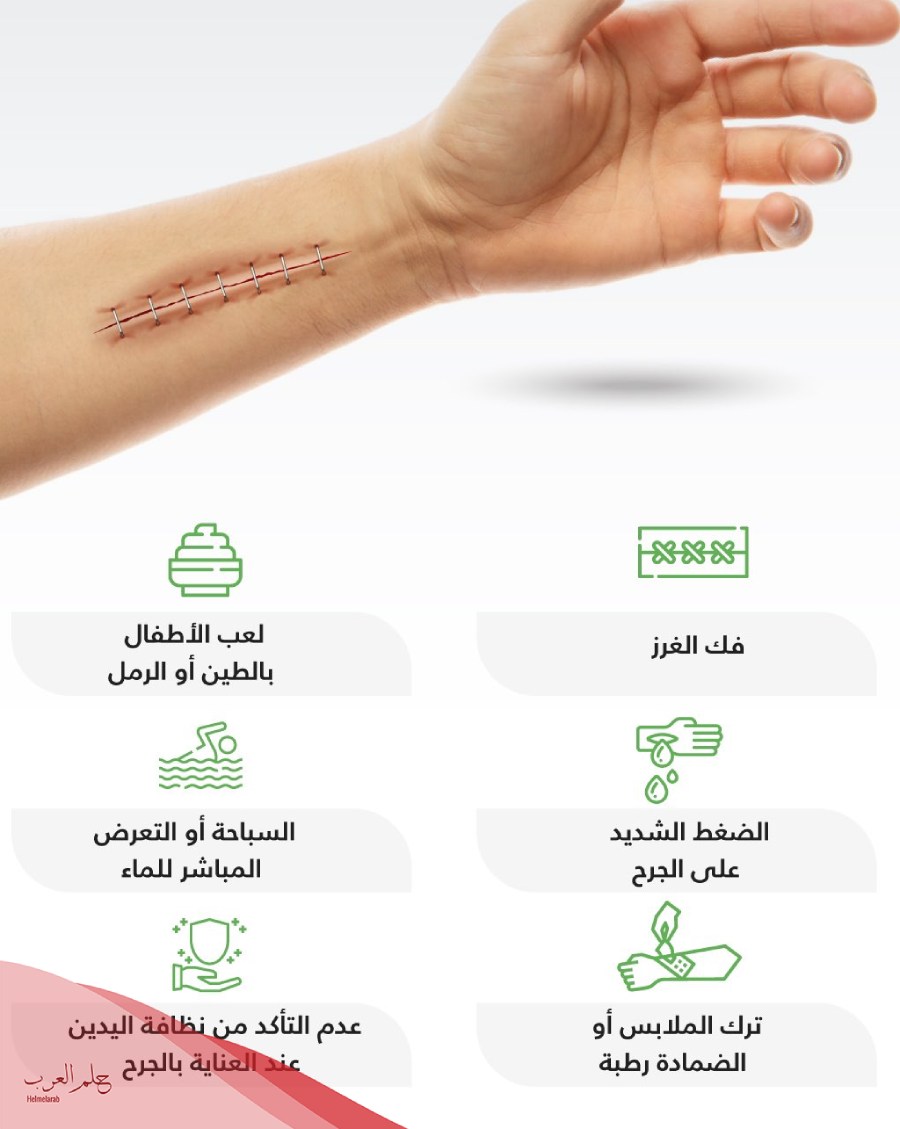 هل تلتئم الخياطة إذا انفتحت 